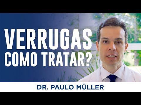 Vídeo: Verrugas Nas Mãos: Causas, Tratamento