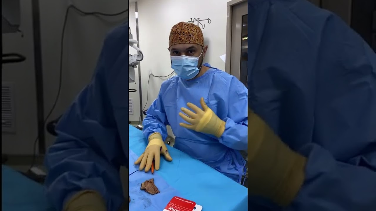 شد الصدر باستخدام الطريقة البرازيلية 