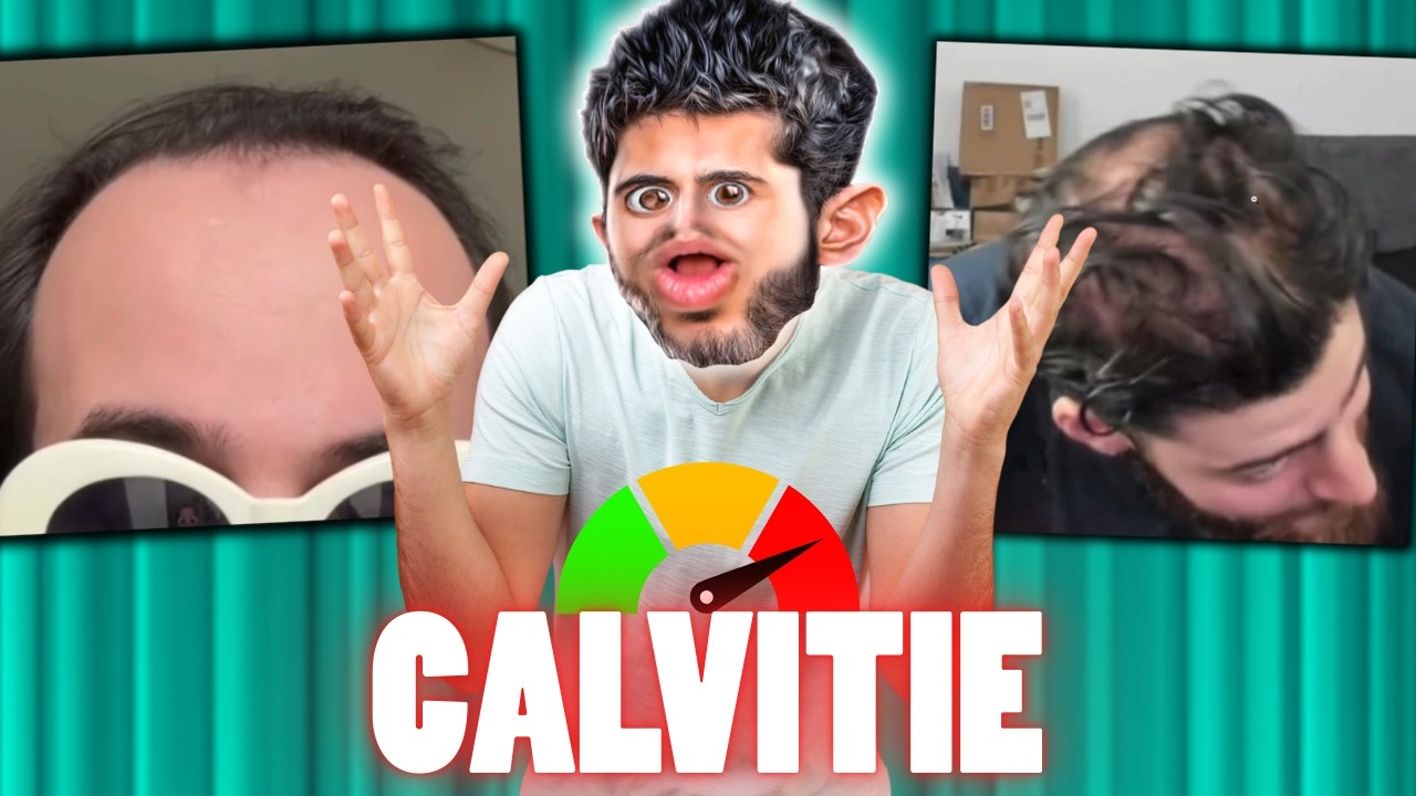 Je JUGE vos CALVITIES 🤣 (Byilhan a de la concurrence)