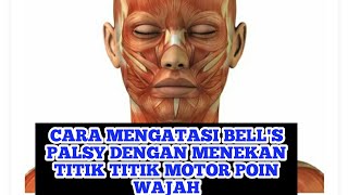 Physiotherapy- Physiotherapy Treatment of Bell's Palsy by pressing the facial motor points