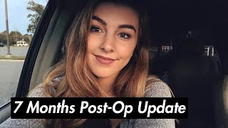 PostOp Month 7 Update + What God Is Doing In My Life