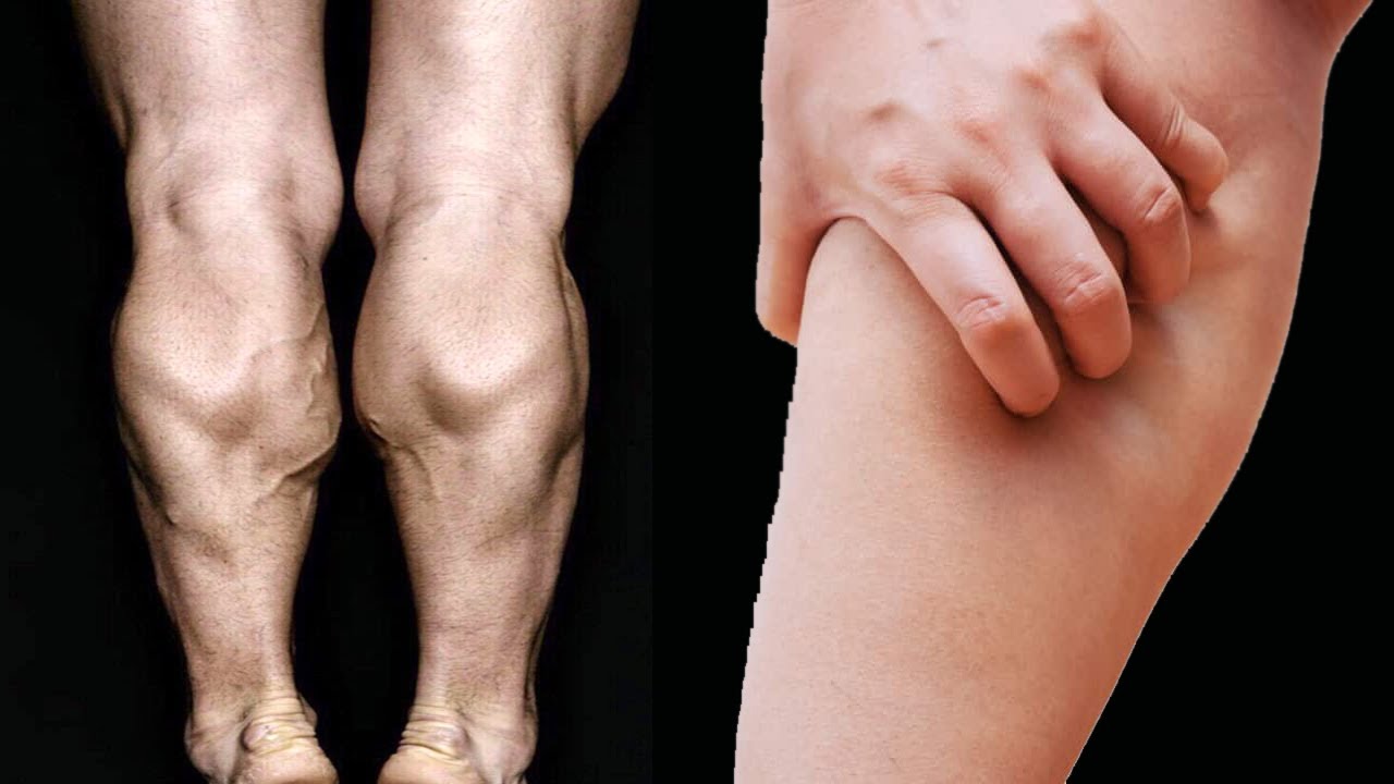 This Is Why my Legs Cramp at Night (SURPRISING CAUSE and HOW TO FIX IT