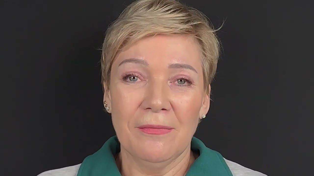 Новый взгляд за 1 месяц: верхняя + нижняя блефаропластика