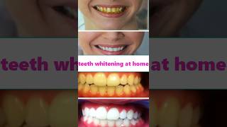 teeth whitening at home shorts ytshorts youtubeshorts viralshorts trendingshorts