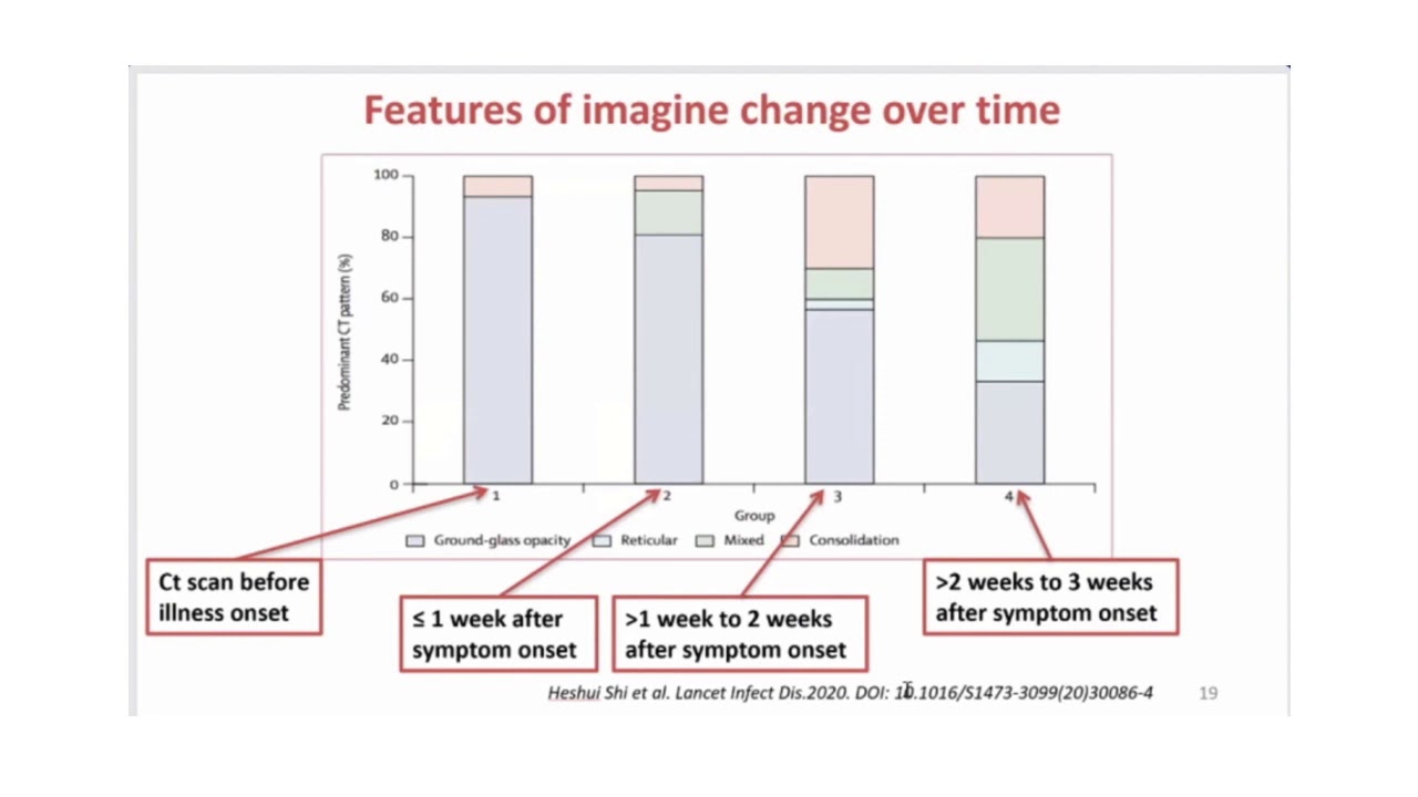 COVID 19 Intersections with Cardiology 3 23 2020 - YouTube