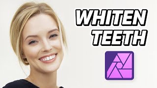 How to Whiten Teeth in Affinity Photo