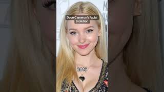 Dove Cameron 's facial Evolution