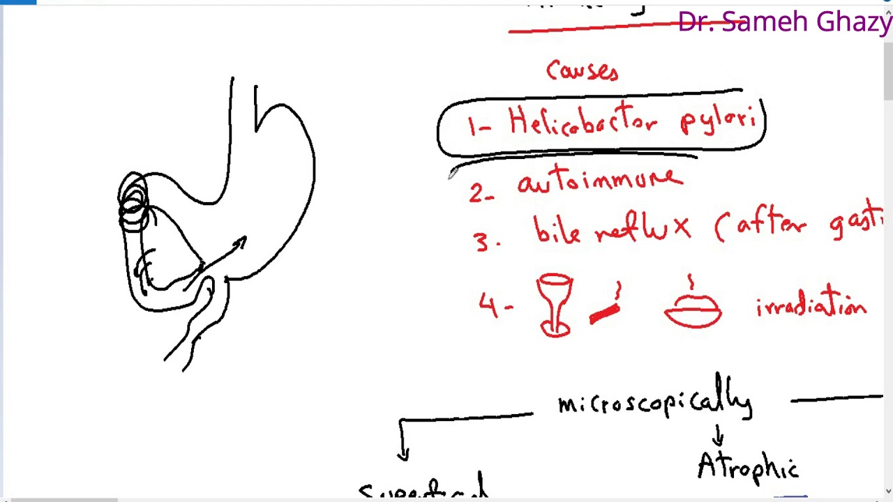 Systemic pathology 22 : GIT 3  ( gastritis ) DR.SAMEH GHAZY