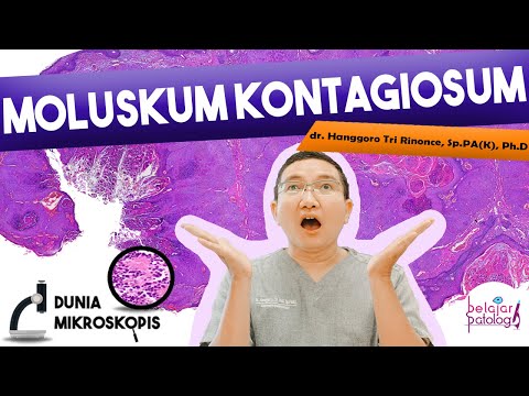 Video: Apakah moluskum akan kembali?