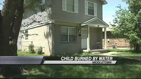 Child Injured by Scalding Water Ruled Accidental