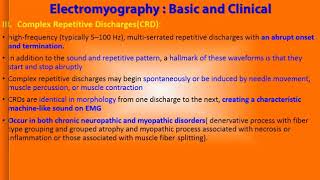 EMG and spontaneous activity 2