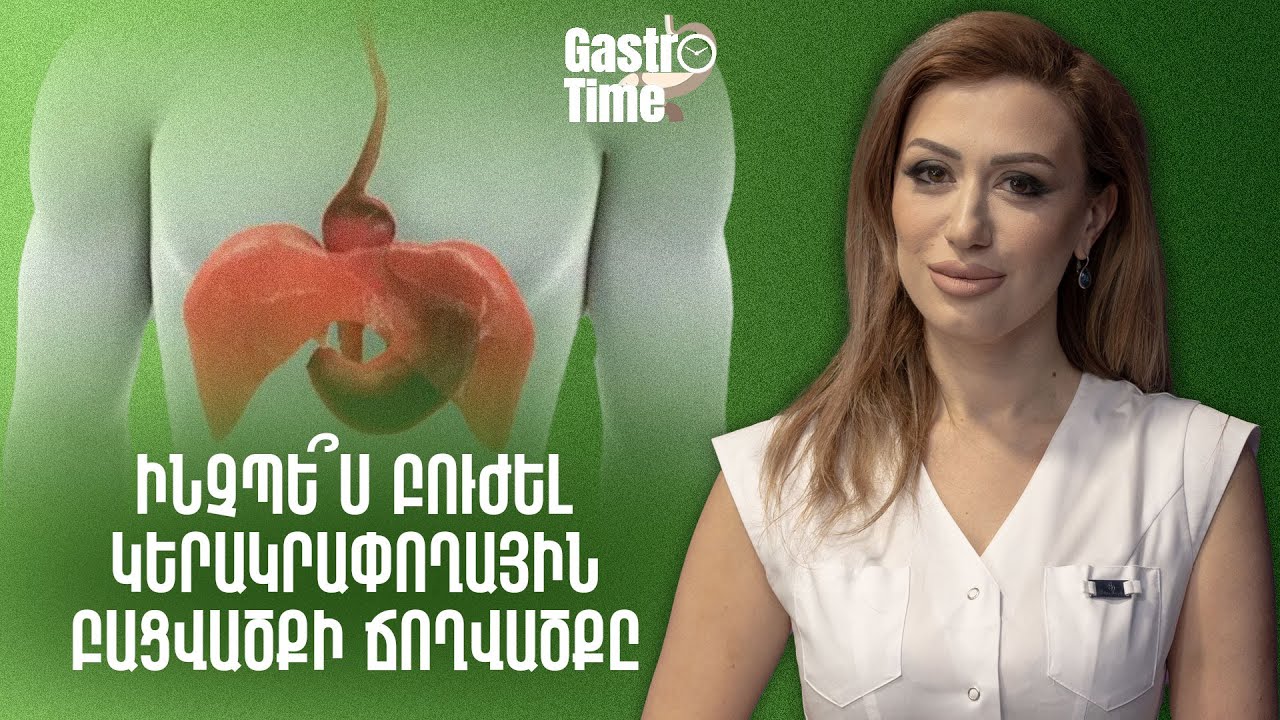 Ինչպե՞ս բուժել կերակրափողային բացվածքի ճողվածքը | GastroTime 96