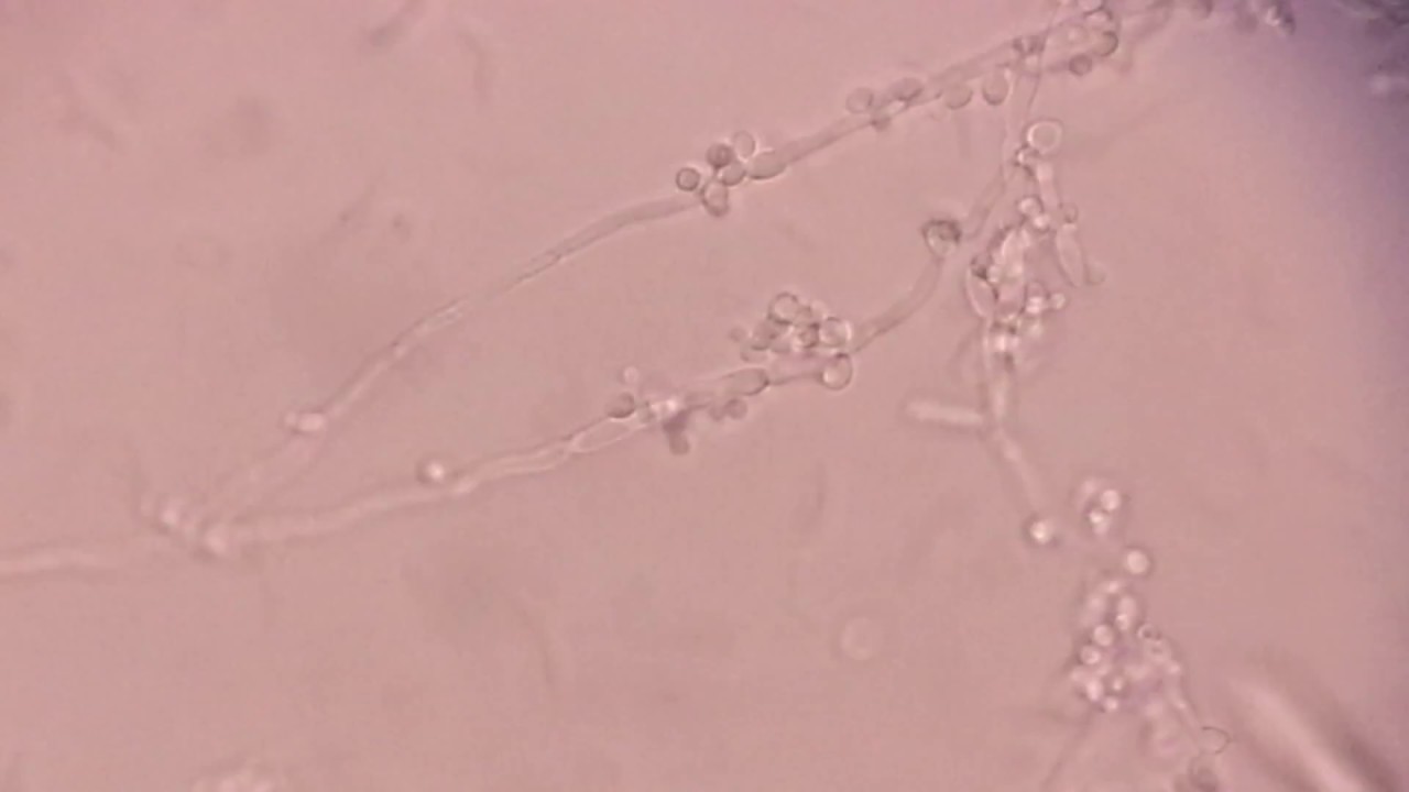 Chlamydospore formation of Candida albicans YouTube