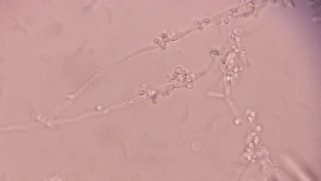 Chlamydospore formation of Candida albicans - YouTube