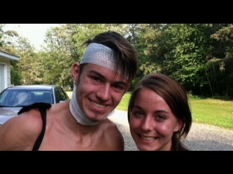 Minnesota Wolf Attack: Teen Pulls Wolf's Jaws Off His Head With Bare Hands