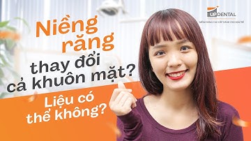 Niềng răng có làm thay đổi khuôn mặt? Review của  Bích Thuỷ