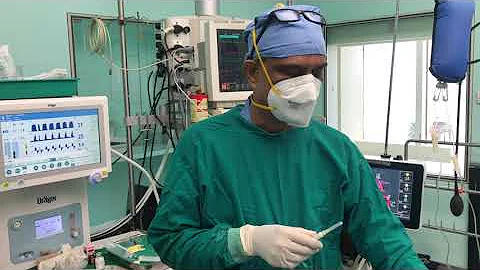 Blind new technique for IJV cannulation