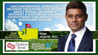 Circumferential MIS Treatment for Severe Adult Spinal Deformity - Neel Anand, M.D.