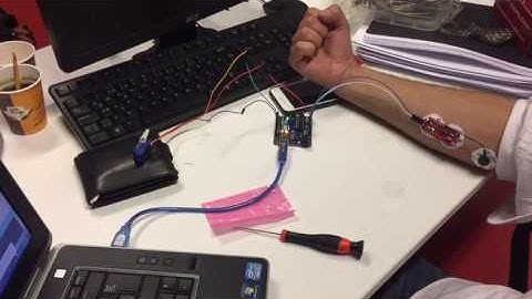 Controlling servomotors using EMG sensor (delay problem)