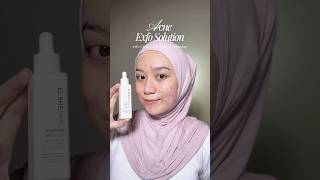 Acne Exfo Solution ✨ #skincare #serum #exfoliate #peelingserum #elsheskin #acne #skin