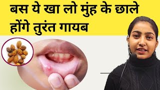 बस ये खा लो मुंह के छाले होंगे तुरंत गायब|Mouth ulcer |