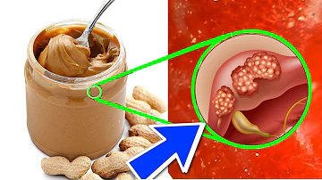 ¿La mantequilla de cacahuete es rica en fibra?