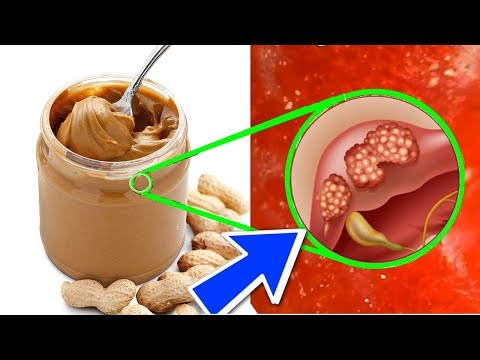 NO Vuelvas a Comer MANTEQUILLA de CACAHUETE 🥜 Hasta ver este VÍDEO