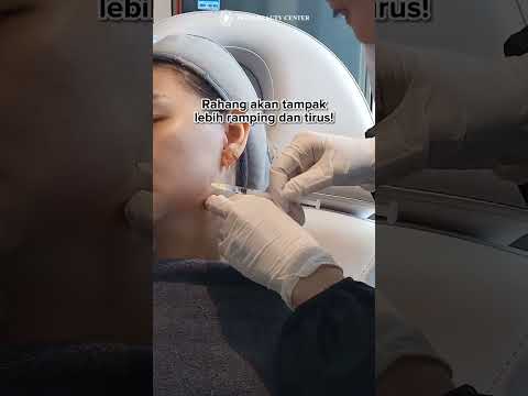 Video: Dapatkah dokter gigi memberikan botox?