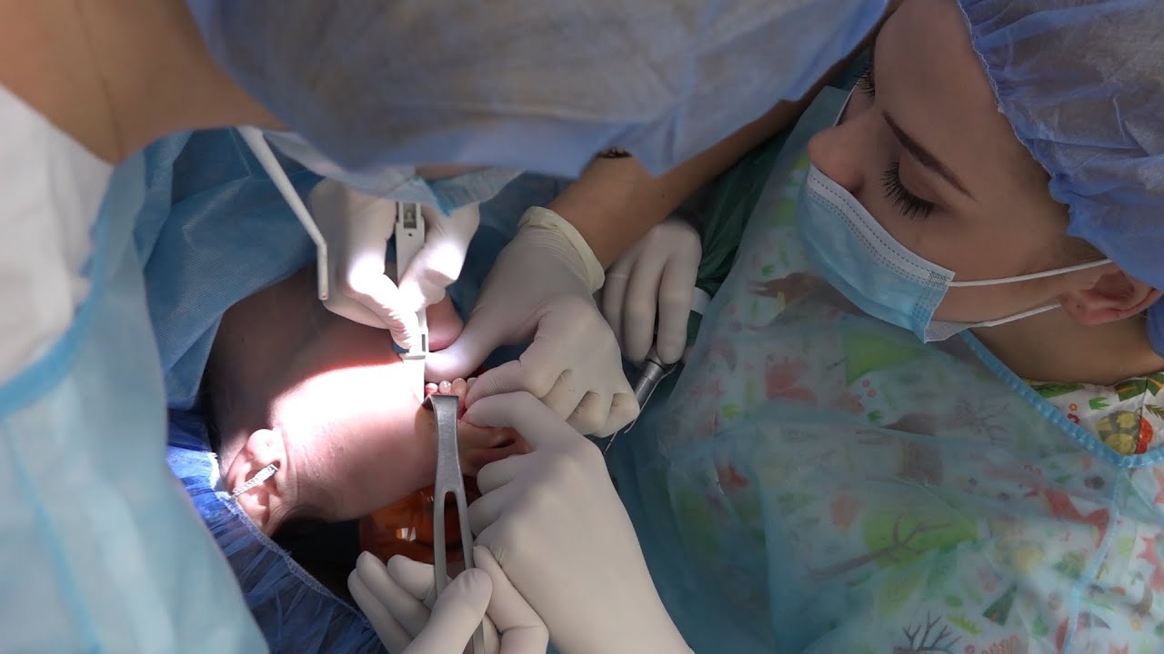 Practiculum Implantologii Sezon VIII B Sesja 7 zabieg 2