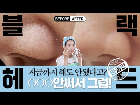 HOW TO GET RID OF BLACKHEADS | SKINCARE ROUTINE | DIRECTOR PI