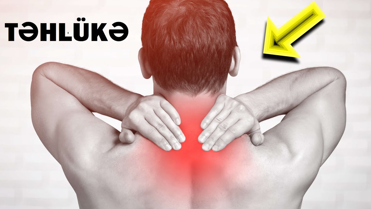 TƏHLÜKƏ! Kürəyi Ağrıyanlar MÜTLƏQ BAXSIN #neyrocerrah #beyincerrahı #onurgacerrahı #drbehruzeyvazov