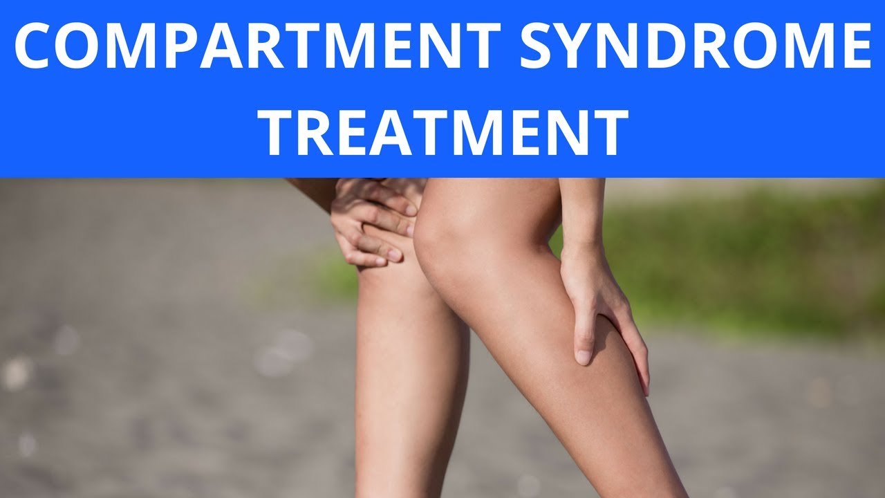 Compartment Syndrome Treatment YouTube