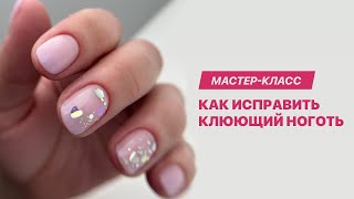 Как исправить клюющий ноготь гелем