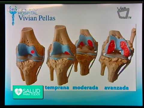 Vídeo: Apriete En La Rodilla: Causas, Síntomas Y Tratamientos