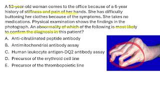 USMLE 2026 Step 1 Free 120 Breakdown - Question 2