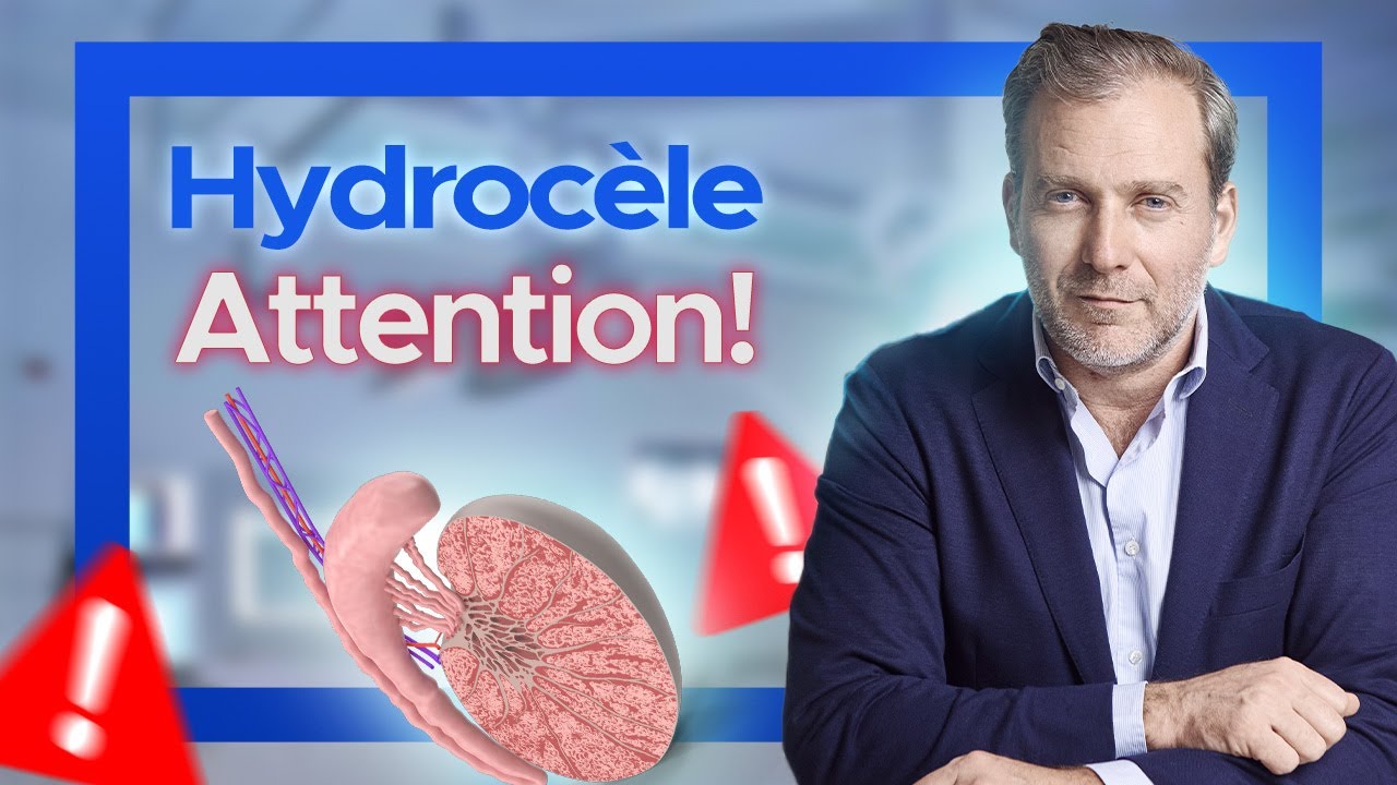 L'hydrocèle