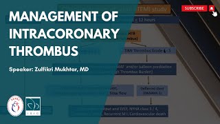 Distance Learning (Sept 12th, 2020) - Management of Intracoronary Thrombus