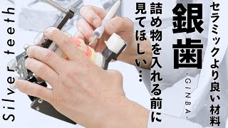 【銀歯】知らないと損をする！本当はとても良い健康保険適用の材料銀歯