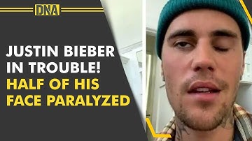 Justin Bieber cancels shows after half of face left paralysed by virus, says ‘Keep Me in Prayers’