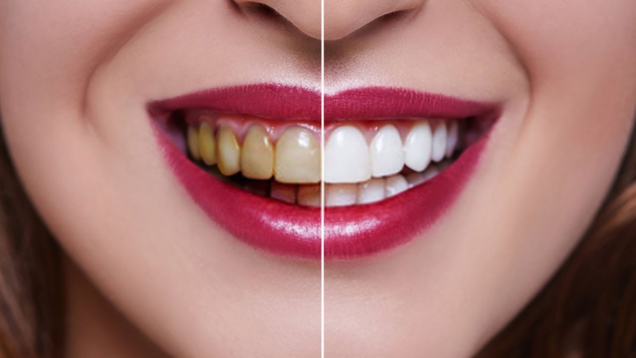 does oil pulling work on cavities If You Tried Oil Pulling For One Week Here's What Happened!