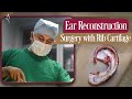 Ear Reconstruction Surgery With The Patient&#39;s Own Rib Cartilage | Designer Bodyz | Dr. Parag Telang