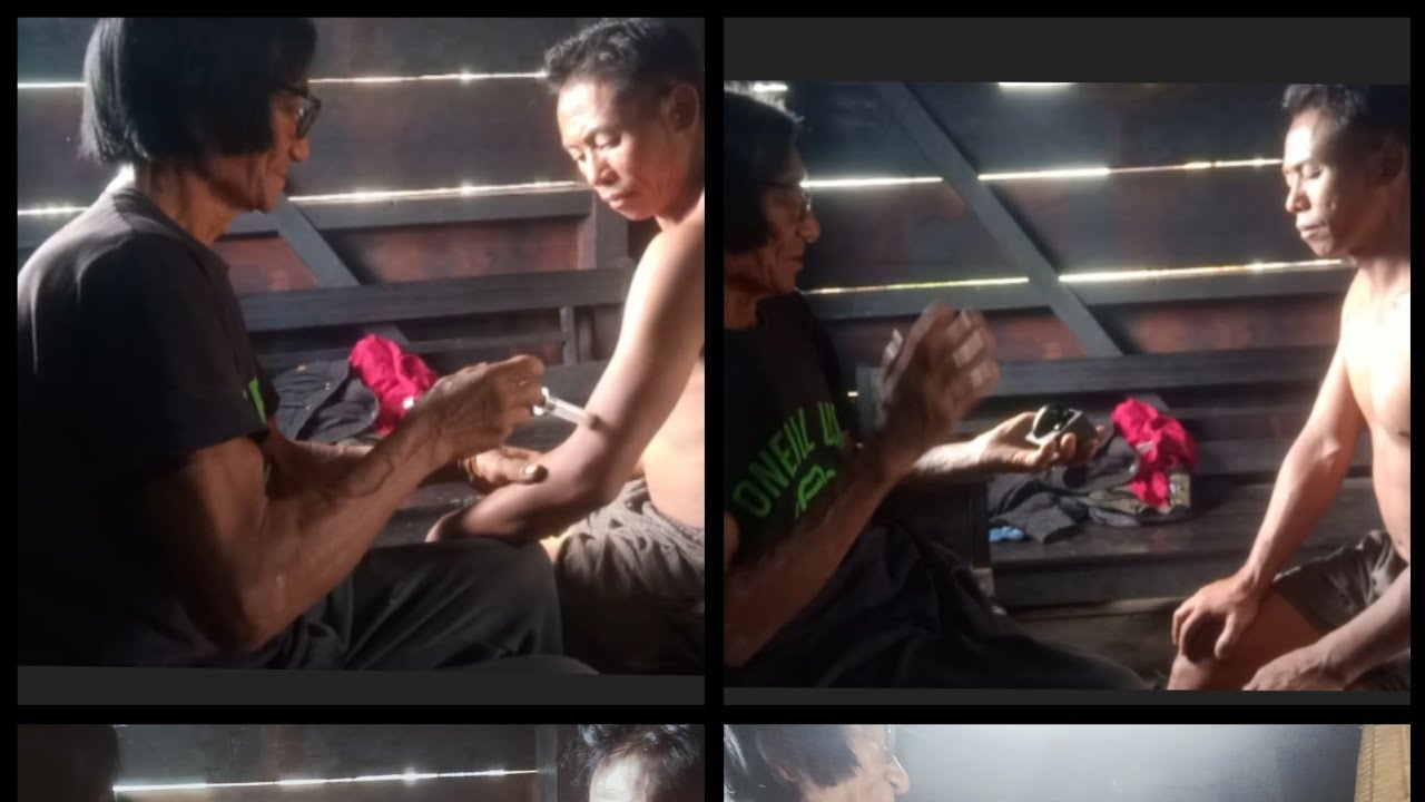 Local doctor checking up the patient with local ultrasound .