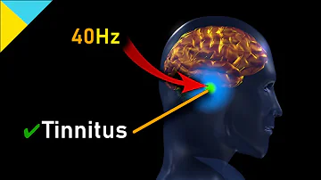 Tinnitus "MIRACLE" Quantum Healing Frequency HAS ARRIVED! 40Hz • Gamma Waves