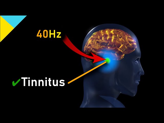 Tinnitus MIRACLE Quantum Healing Frequency HAS ARRIVED! 40Hz • Gamma Waves class=