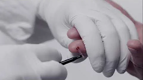 Swelab Alfa Plus capillary sample inlet