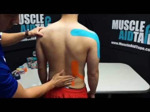 MuscleAidTape: Limited Range of Motion in Shoulders