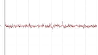 Katp Channel Atp-Sensitive Potassium Channel Dynamics In Real Time