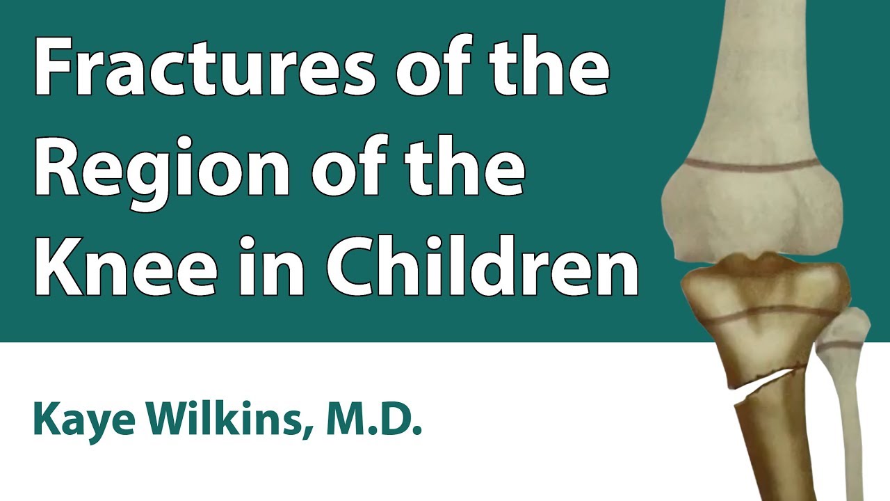 Fractures Of The Region Of The Knee In Children YouTube