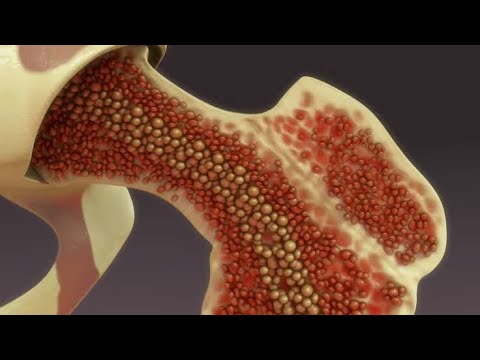 Wideo: Które narządy są zdolne do hematopoezy pozaszpikowej?