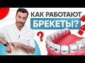 Как работают брекеты и почему так медленно? Современная ортодонтия